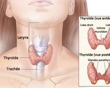 Thyroïde