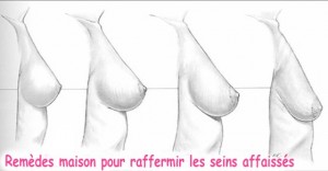 Seins affaissées